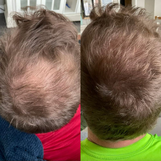 Nuvellus - Serum za napredni rast kose u roll-on formi