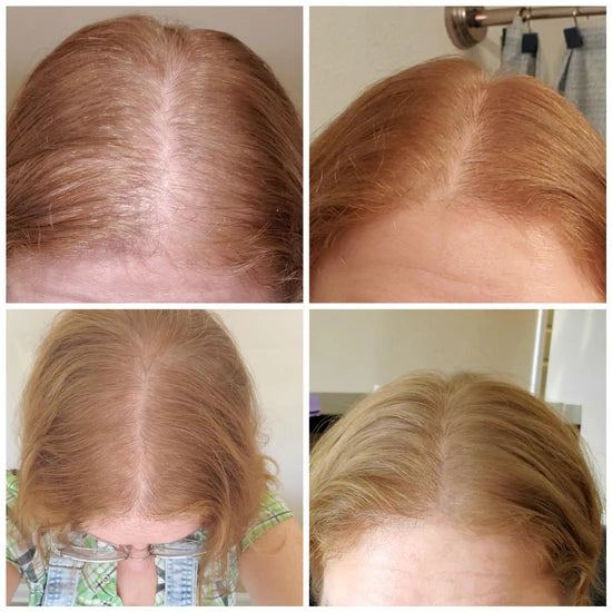 Nuvellus - Serum za napredni rast kose u roll-on formi