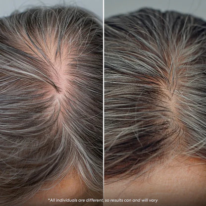 Nuvellus - Serum za napredni rast kose u roll-on formi